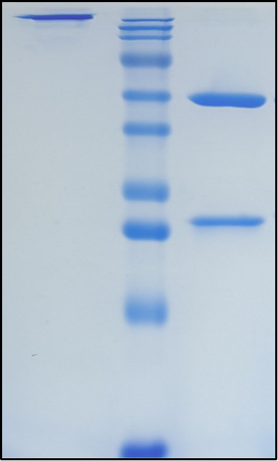 (Actoxumab)Biosimilar Reference Antibody