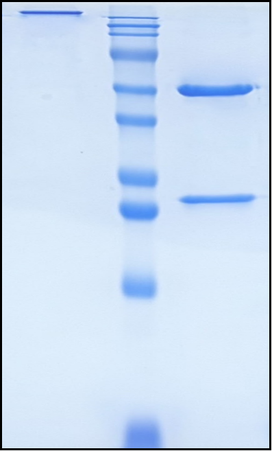 (Aducanumab)Biosimilar Reference Antibody