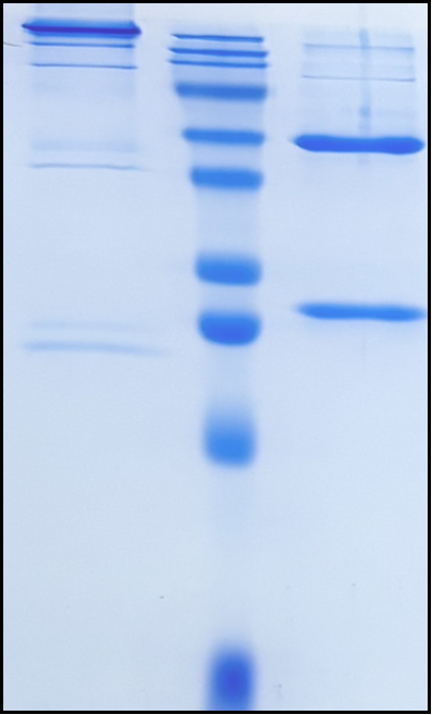 (Alemtuzumab)Biosimilar Reference Antibody