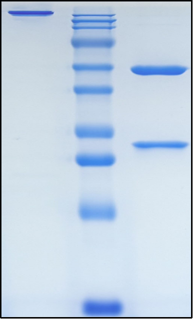 (Alirocumab)Biosimilar Reference Antibody