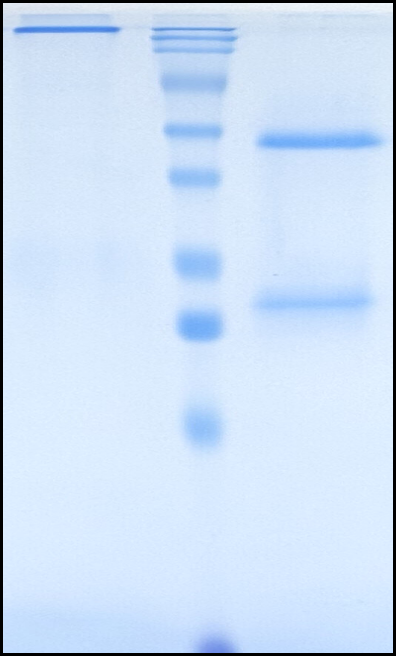 (Andecaliximab)Biosimilar Reference Antibody