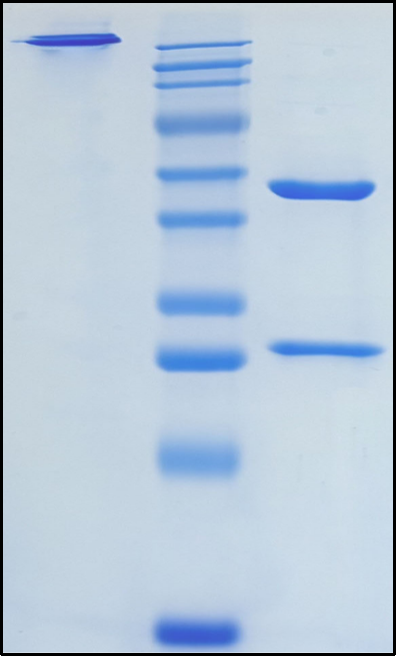 (Anifrolumab)Biosimilar Reference Antibody