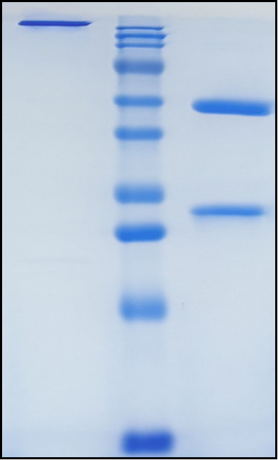 (Anrukinzumab)Biosimilar Reference Antibody