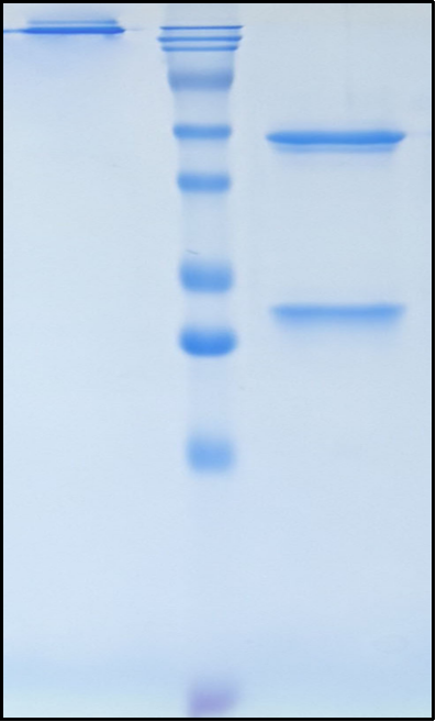 (Aselizumab)Biosimilar Reference Antibody