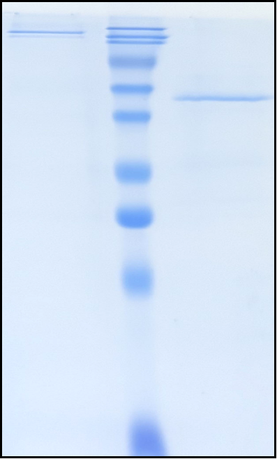 (Atinumab)Biosimilar Reference Antibody