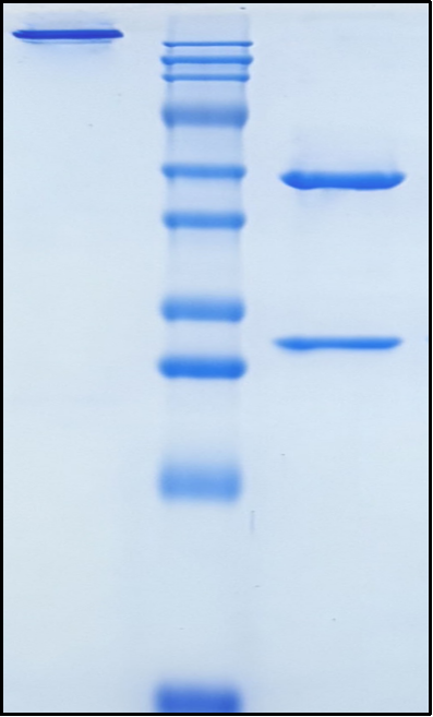 (Bapineuzumab)Biosimilar Reference Antibody