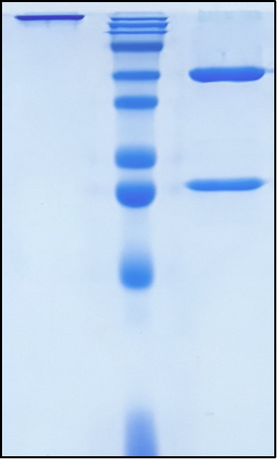 (Benmelstobart)Biosimilar Reference Antibody