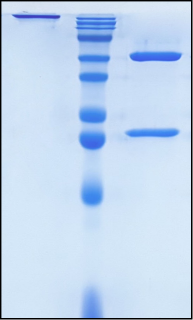 (Benralizumab)Biosimilar Reference Antibody