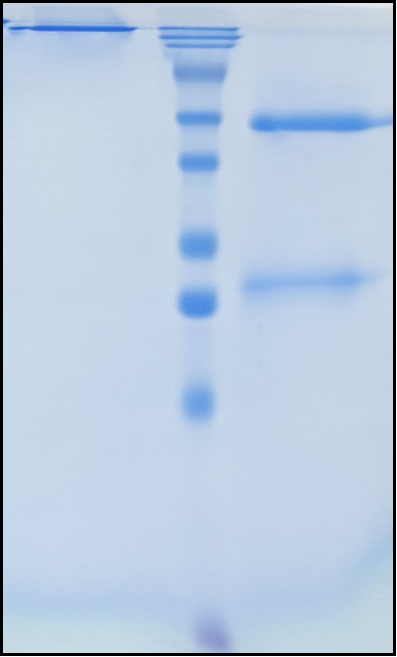 (Bepranemab)Biosimilar Reference Antibody
