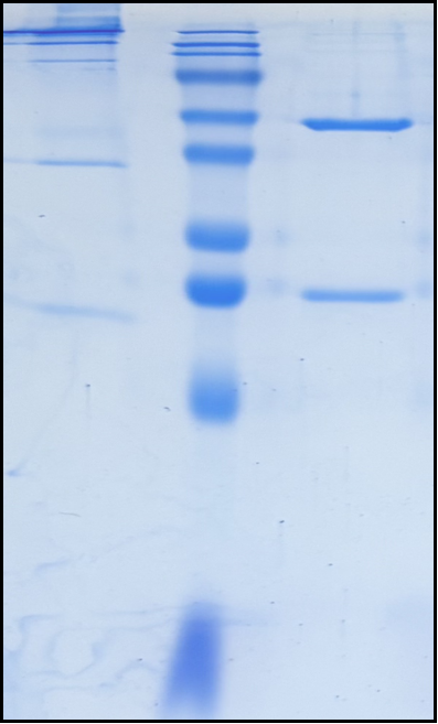 (Bersanlimab)Biosimilar Reference Antibody