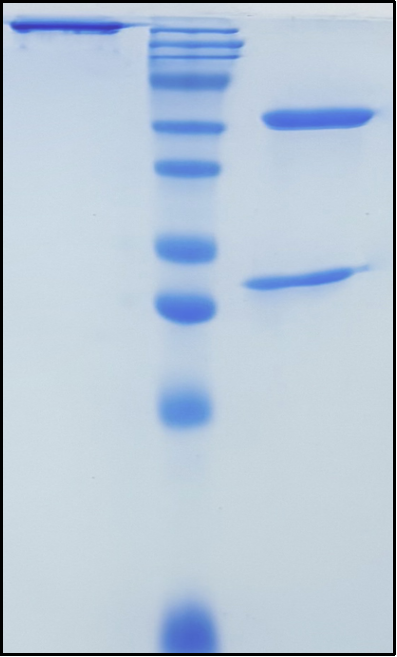 (Bezetabart)Biosimilar Reference Antibody
