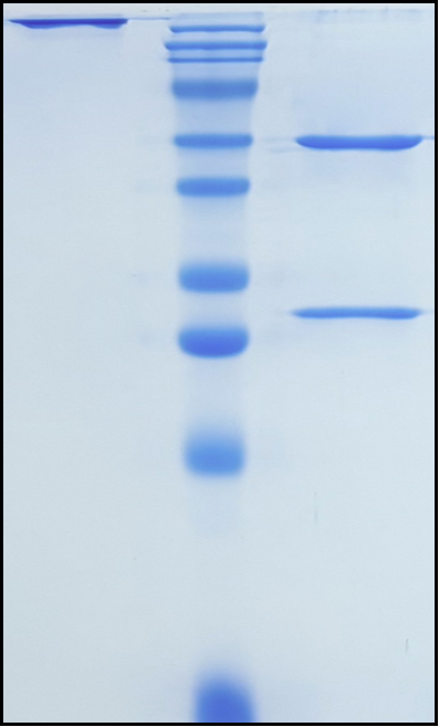 (Bezlotoxumab)Biosimilar Reference Antibody