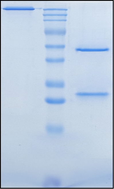 (Bococizumab)Biosimilar Reference Antibody