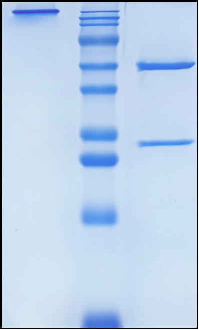 (Briakinumab)Biosimilar Reference Antibody