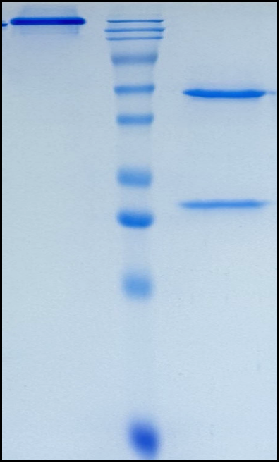 (Camrelizumab)Biosimilar Reference Antibody