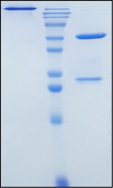 (Carlumab)Biosimilar Reference Antibody