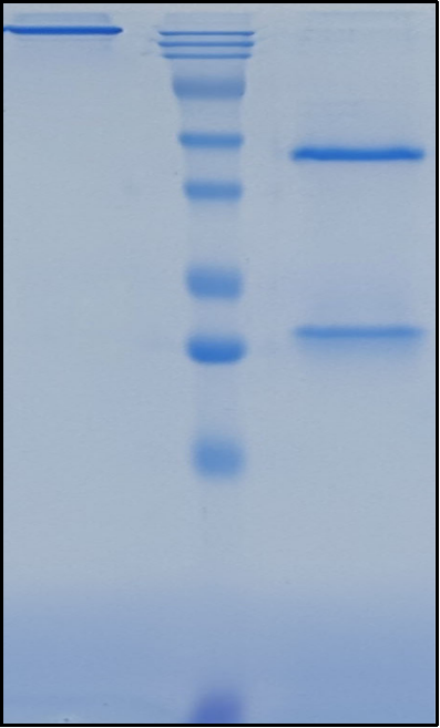 (Cemiplimab)Biosimilar Reference Antibody