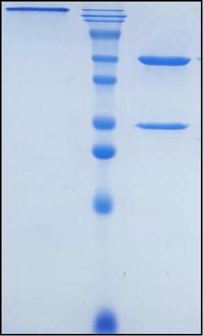 (Cinpanemab)Biosimilar Reference Antibody