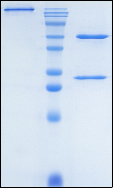 (Dectrekumab)Biosimilar Reference Antibody