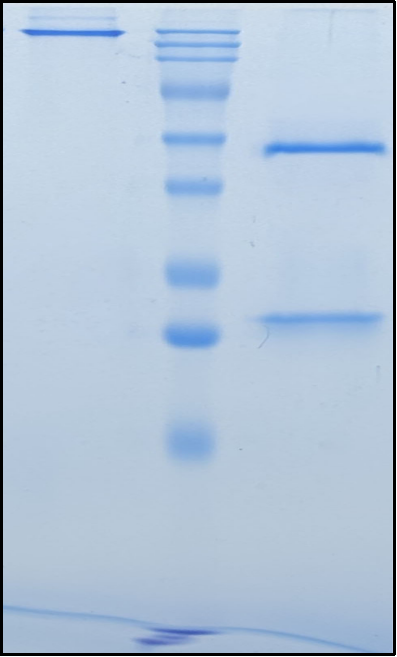 (Devextinetug)Biosimilar Reference Antibody