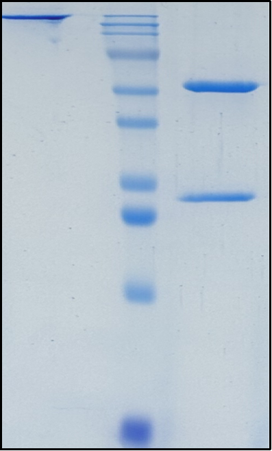 (Dezamizumab)Biosimilar Reference Antibody