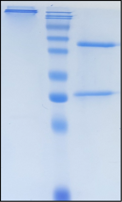 (Eblasakimab)Biosimilar Reference Antibody