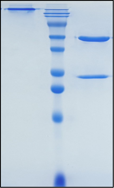 (Ebronucimab)Biosimilar Reference Antibody