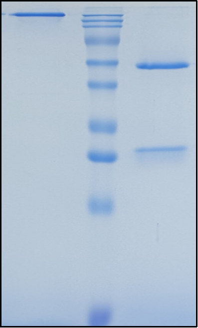 (Erenumab)Biosimilar Reference Antibody