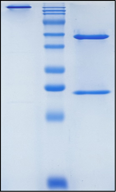 (Exbivirumab)Biosimilar Reference Antibody