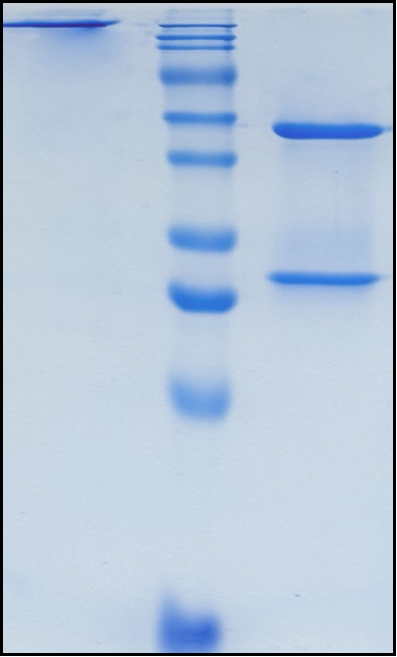 (Exlinkibart)Biosimilar Reference Antibody