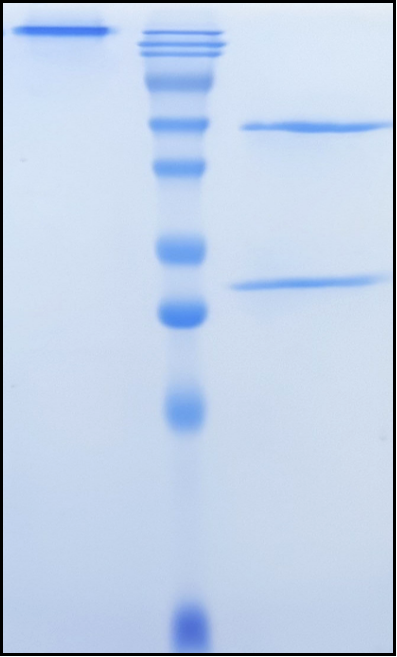 (Fasinumab)Biosimilar Reference Antibody