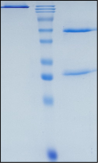 (Fletikumab)Biosimilar Reference Antibody