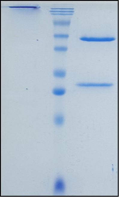 (Freneslerbart)Biosimilar Reference Antibody