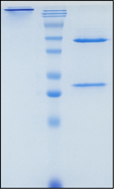 (Galcanezumab)Biosimilar Reference Antibody