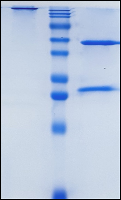 (Ganitumab)Biosimilar Reference Antibody