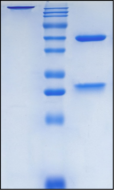 (Gimsilumab)Biosimilar Reference Antibody