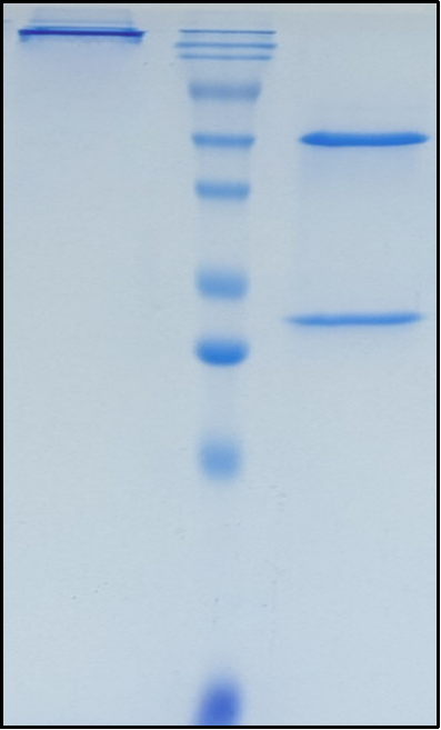 (Ginisortamab)Biosimilar Reference Antibody
