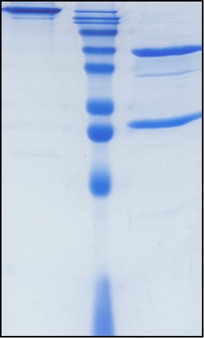 (Girentuximab)Biosimilar Reference Antibody
