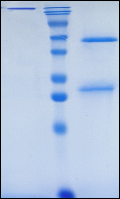(Glembatumumab)Biosimilar Reference Antibody