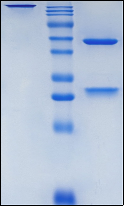 (Golimumab)Biosimilar Reference Antibody