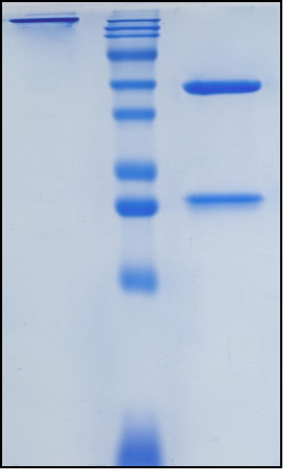 (Gorivitug)Biosimilar Reference Antibody