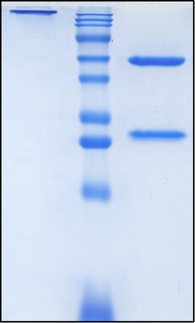 (Gumokimab)Biosimilar Reference Antibody