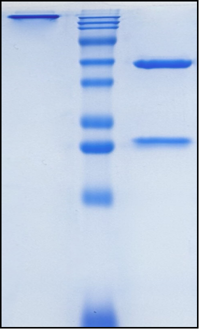 (Guselkumab)Biosimilar Reference Antibody