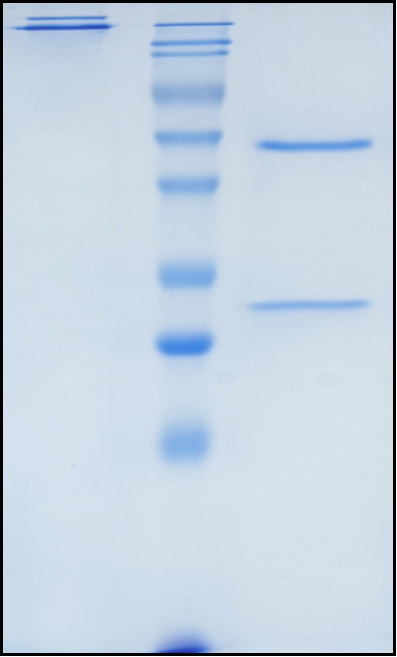 (Ibalizumab)Biosimilar Reference Antibody