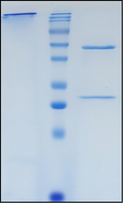 (Inclacumab)Biosimilar Reference Antibody