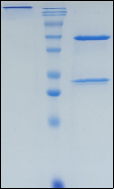 (Infliximab)Biosimilar Reference Antibody