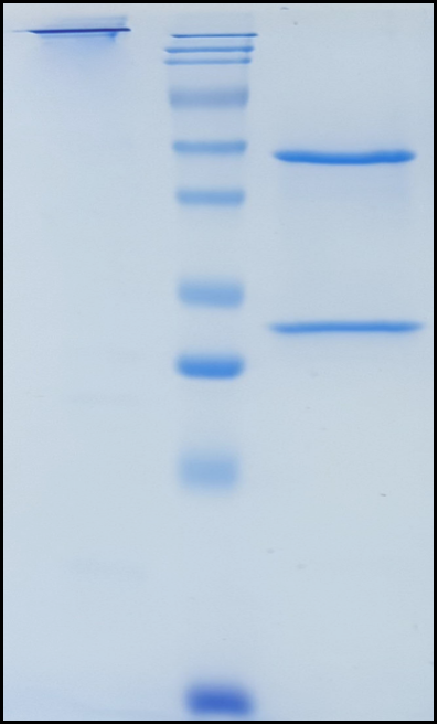 (Ixekizumab)Biosimilar Reference Antibody