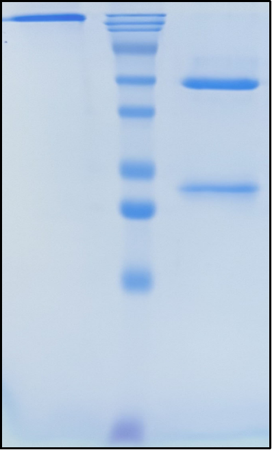 (Lacutamab)Biosimilar Reference Antibody