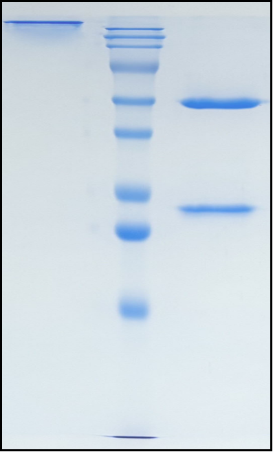 (Lanadelumab)Biosimilar Reference Antibody