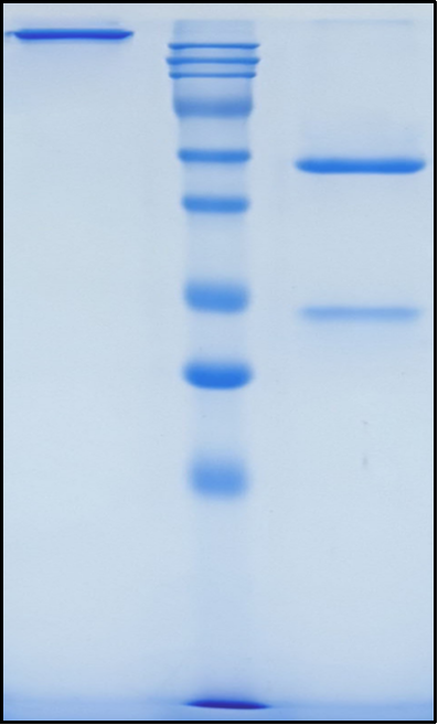 (Lenvervimab)Biosimilar Reference Antibody
